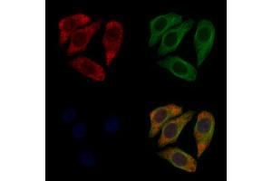 ABIN6258888 and ABIN6274835 staining Hela cells by IF/ICC. (SGCA 抗体  (Internal Region))