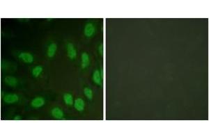 Immunofluorescence analysis of HeLa cells, using AML1 (Ab-303) Antibody. (RUNX1 抗体  (AA 269-318))