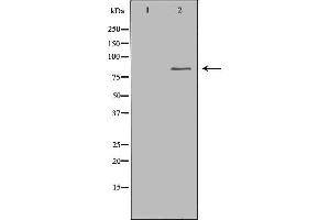 Western blot analysis of extracts of colo , using CHAT antibody. (Choline Acetyltransferase 抗体  (C-Term))