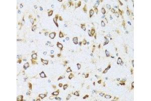 Immunohistochemistry of paraffin-embedded Mouse brain using NRG4 Polyclonal Antibody at dilution of 1:100 (40x lens). (Neuregulin 4 抗体)