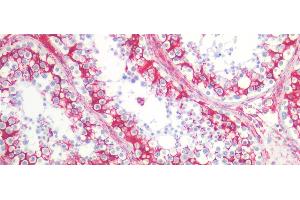 Immunohistochemistry (IHC) image for anti-Vimentin (VIM) antibody (ABIN7426163)