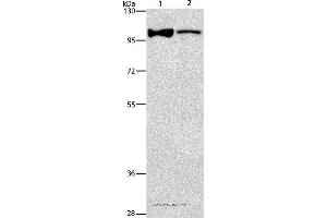 Western blot analysis of Lovo cell and human fetal brain tissue, using ADCY3 Polyclonal Antibody at dilution of 1:312.
