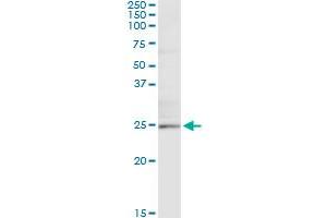 Immunoprecipitation of TWIST1 transfected lysate using anti-TWIST1 monoclonal antibody and Protein A Magnetic Bead , and immunoblotted with TWIST1 MaxPab rabbit polyclonal antibody. (TWIST1 抗体  (AA 106-174))
