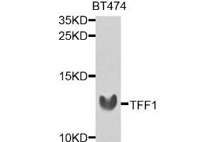 Western blot analysis of extracts of BT-474 cells, using TFF1 antibody. (TFF1 抗体)