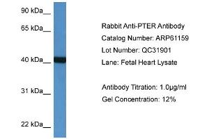 Western Blotting (WB) image for anti-Phosphotriesterase Related (PTER) (N-Term) antibody (ABIN2788700) (PTER 抗体  (N-Term))