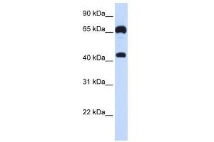 GUCY1B3 antibody used at 1 ug/ml to detect target protein. (GUCY1B3 抗体  (N-Term))