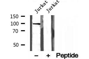 Western blot analysis of extracts of Jurkat cells, using NOD2 antibody. (NOD2 抗体  (N-Term))