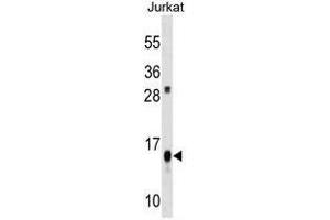 ATP5D Antibody (C-term) western blot analysis in Jurkat cell line lysates (35µg/lane). (ATP5F1D 抗体  (C-Term))