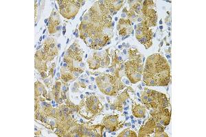 Immunohistochemistry of paraffin-embedded human stomach using PLCG1 Antibody (ABIN2737388) at dilution of 1:100 (40x lens). (Phospholipase C gamma 1 抗体)