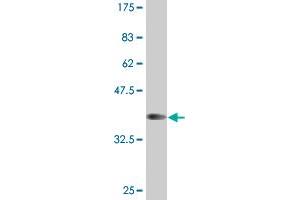 Western Blot detection against Immunogen (37. (HOXB1 抗体  (AA 101-210))