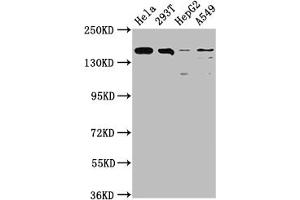 Western Blot Positive WB detected in: Hela whole cell lysate, 293T whole cell lysate, HepG2 whole cell lysate, A549 whole cell lysate All lanes: BRD4 antibody at 1:1500 Secondary Goat polyclonal to rabbit IgG at 1/50000 dilution Predicted band size: 153, 81, 89 kDa Observed band size: 153 kDa (Recombinant BRD4 抗体)