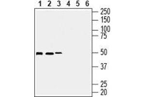 Western blot analysis of human Burkitt's lymphoma Daudi (lanes 1 and 3), human T-cell leukemia Jurkat (lanes 2 and 5) and human breast adenocarcinoma MCF-7 cell lysates (lanes 3 and 6): - 1-3. (Septin 7 抗体  (Intracellular))