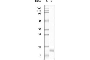 Western Blotting (WB) image for anti-Synuclein, gamma (Breast Cancer-Specific Protein 1) (SNCG) (truncated) antibody (ABIN2464104) (SNCG 抗体  (truncated))