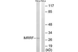 Western blot analysis of extracts from HeLa cells, using MRRF Antibody. (MRRF 抗体  (AA 181-230))