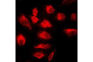 Immunofluorescent analysis of A20 staining in HeLa cells. (IGKV1-27 抗体  (Center))