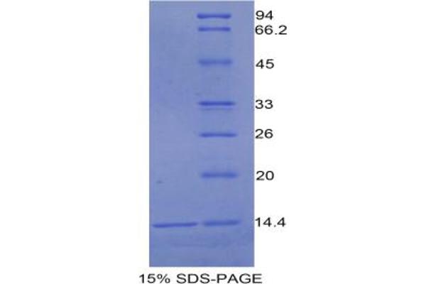 Urocortin 1 Protein (UCN1)