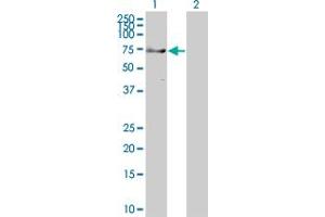 Western Blot analysis of TRIM9 expression in transfected 293T cell line ( H00114088-T01 ) by TRIM9 MaxPab polyclonal antibody. (TRIM9 抗体  (AA 1-550))
