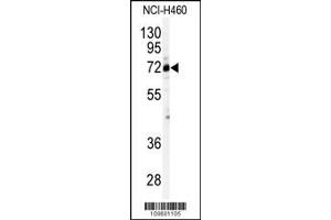 Western blot analysis of anti-CSTF2 Antibody (N-term) (ABIN388655 and ABIN2838407) in NCI- cell line lysates (35 μg/lane).