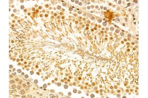 ABIN7094244 and ABIN7098291 at 1/100 staining Rat testis tissue by IHC-P. (FZR1 抗体  (Internal Region))