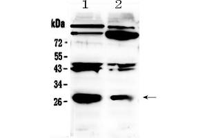 Western blot analysis of PDGF beta using anti- PDGF beta antibody . (PDGFB 抗体  (C-Term))
