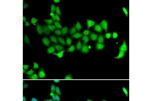 Immunofluorescence analysis of A549 cells using HSPA14 Polyclonal Antibody (HSPA14 抗体)