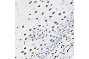 Immunohistochemistry of paraffin-embedded human esophageal using Histone H1t Rabbit pAb (ABIN7267716) at dilution of 1:100 (40x lens). (Histone H1 抗体  (AA 150-207))