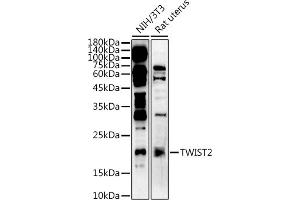 Western blot analysis of extracts of various cell lines, using  at 1:500 dilution. (TWIST2 抗体  (AA 1-70))