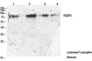 Western Blotting (WB) image for anti-Forkhead Box P1 (FOXP1) (C-Term) antibody (ABIN3178244) (FOXP1 抗体  (C-Term))