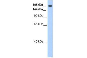 SCN5A antibody used at 0. (SCN5A 抗体  (C-Term))