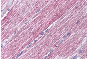 Human Skeletal Muscle (formalin-fixed, paraffin-embedded) stained with RAB7A antibody ABIN299824 at 10 ug/ml followed by biotinylated goat anti-rabbit IgG secondary antibody ABIN481713, alkaline phosphatase-streptavidin and chromogen. (RAB7A 抗体  (AA 90-140))