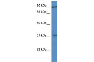 WB Suggested Anti-Mid2 Antibody   Titration: 1. (Midline 2 抗体  (N-Term))