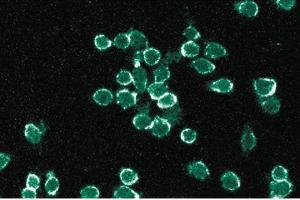 Immunofluorescent staining of mouse macrophage cells with gp91[phox] antibody.
