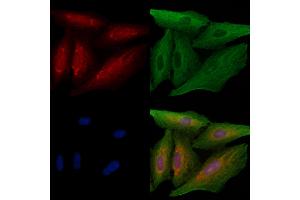 ABIN6263891 and ABIN6278615 staining  cells by IF/ICC.