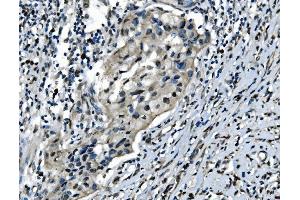 IHC analysis of CDC27 using anti-CDC27 antibody (ABIN7602163).