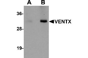Western Blotting (WB) image for anti-VENT Homeobox (VENTX) (Middle Region) antibody (ABIN1031159) (VENTX 抗体  (Middle Region))