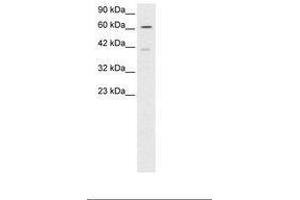 Image no. 2 for anti-SNW Domain Containing 1 (SNW1) (AA 103-152) antibody (ABIN6735801) (SNW1 抗体  (AA 103-152))