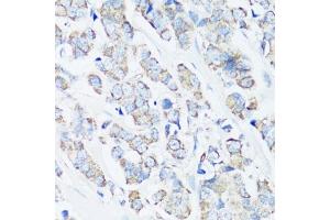 Immunohistochemistry (IHC) image for anti-Proto-oncogene tyrosine-protein kinase Src (Src) (AA 1-80) antibody (ABIN6148428)