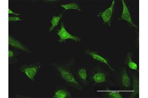 Immunofluorescence of purified MaxPab antibody to EXT1 on HeLa cell. (EXT1 抗体  (AA 1-746))