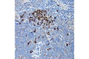 Immunohistochemistry of paraffin-embedded mouse spleen using DDIT3/CHOP Rabbit pAb (ABIN6131562, ABIN6139460, ABIN6139463 and ABIN6215170) at dilution of 1:200 (40x lens). (DDIT3 抗体  (AA 1-169))
