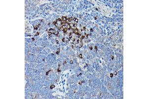 Immunohistochemistry of paraffin-embedded mouse spleen using DDIT3/CHOP Rabbit pAb (ABIN6131562, ABIN6139460, ABIN6139463 and ABIN6215170) at dilution of 1:200 (40x lens). (DDIT3 抗体  (AA 1-169))