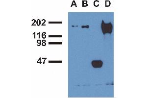 Immunoprecipitation ofEGFR from EGF-treated A431 cells byphosphospecific monoclonal antibodies (A), EM-13 (B), a commercial anti-EGFR polyclonal antibody(C) and anti-EGFR monoclonal mAb108 (D). (EGFR 抗体  (Tyr992))