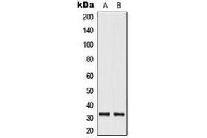 Western blot analysis of ELOVL1 expression in HeLa (A), HepG2 (B) whole cell lysates.