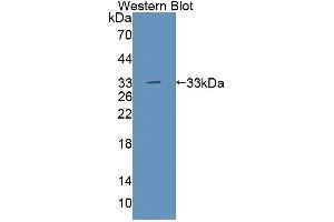 Figure. (Tec Protein Tyrosine Kinase (TEC) (AA 369-622) 抗体)