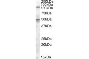 Western Blotting (WB) image for anti-Endoplasmic Reticulum Aminopeptidase 2 (ERAP2) (AA 480-493) antibody (ABIN343047) (ERAP2 抗体  (AA 480-493))