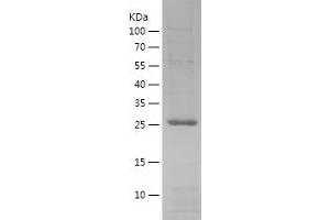 Western Blotting (WB) image for RAB9A, Member RAS Oncogene Family (RAB9A) (AA 2-201) protein (His tag) (ABIN7124766) (RAB9A Protein (AA 2-201) (His tag))