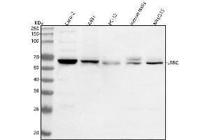 anti-Leucine Rich Repeat Containing 1 (LRRC1) (AA 120-497) antibody