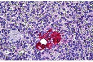 Human Spleen, Macrophages: Formalin-Fixed, Paraffin-Embedded (FFPE) (Galectin 3 抗体  (AA 141-190))