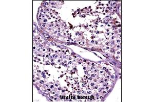 Immunohistochemistry (Paraffin-embedded Sections) (IHC (p)) image for anti-Cancer/testis Antigen 2 (CTAG2) (AA 122-149) antibody (ABIN657689)