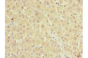 Immunohistochemistry of paraffin-embedded human liver tissue using ABIN7173011 at dilution of 1:100 (TMPRSS6 抗体  (AA 98-301))
