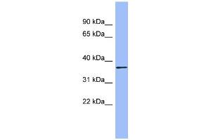 WB Suggested Anti-HAPLN1 Antibody Titration:  0. (HAPLN1 抗体  (N-Term))